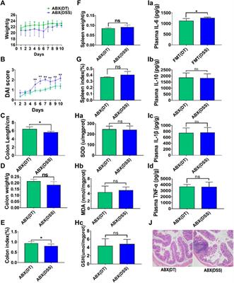 Variation in the Efficacy of Anti-Ulcerative Colitis Treatments Reveals the Conflict Between Precipitating Compatibility of Traditional Chinese Medicine and Modern Technology: A Case of Scutellaria-Coptis